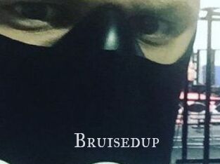 Bruisedup