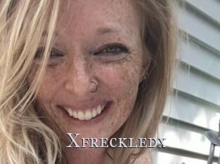 Xfreckledx